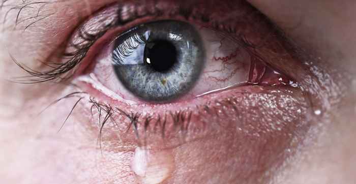 home remedies for watery eyes